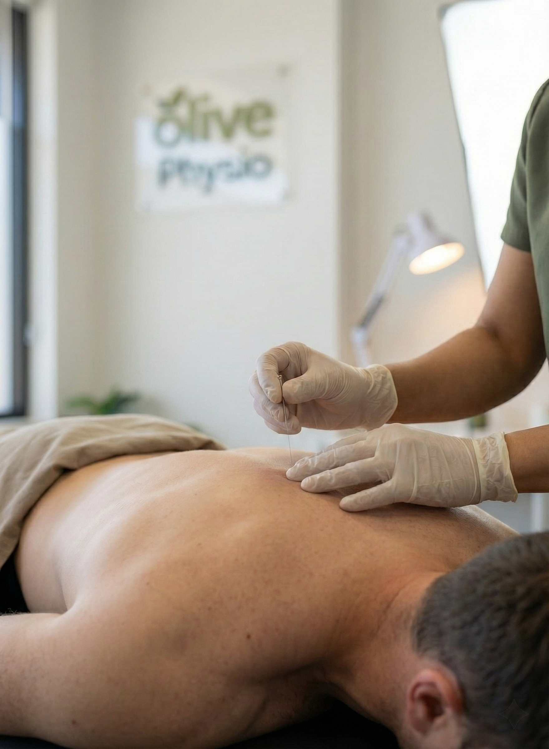 Registered acupuncturist preparing a patient for acupuncture treatment at Olive Physiotherapy in Langley City, BC